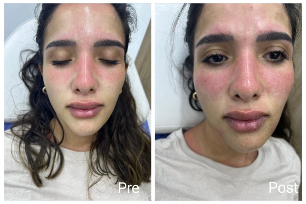 Profile of a skin poster session